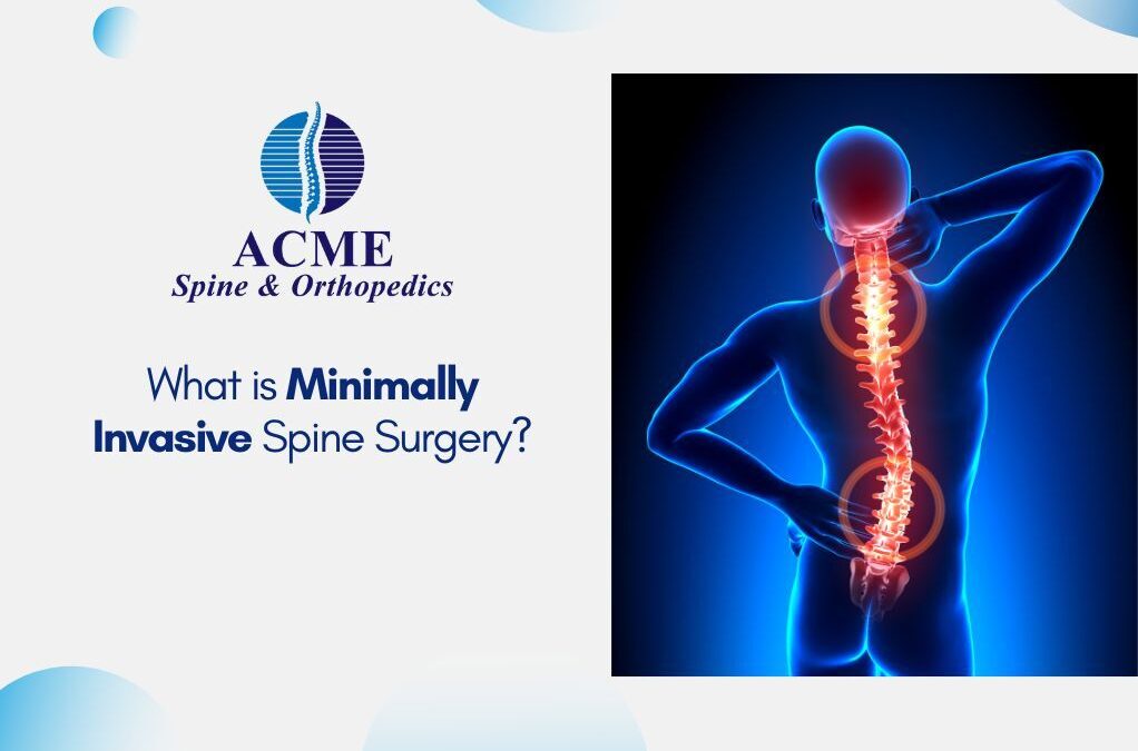 What is Minimally Invasive Spine Surgery?