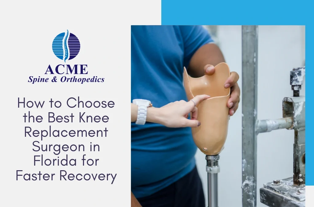 How to Choose the Best Knee Replacement Surgeon in Florida for Faster Recovery