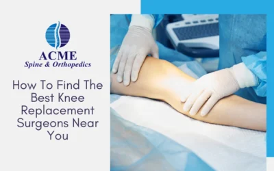 How To Find The Best Knee Replacement Surgeons Near You