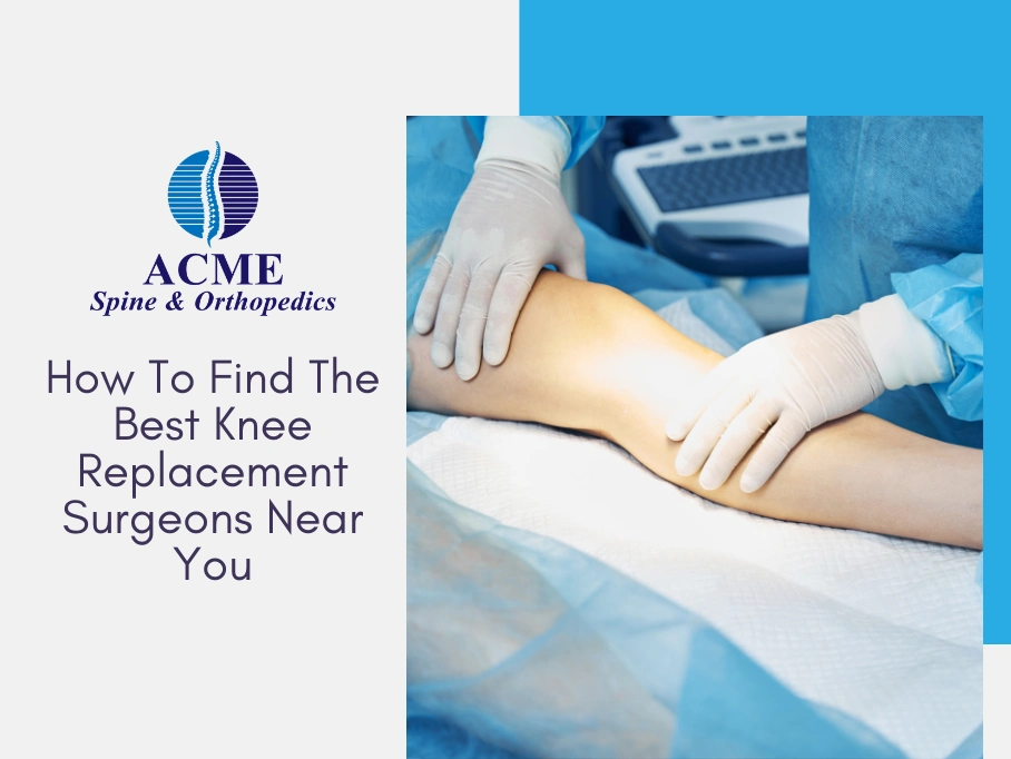find-the-best-knee-replacement-surgeons-near-you find-the-best-knee-replacement-surgeons-near-you